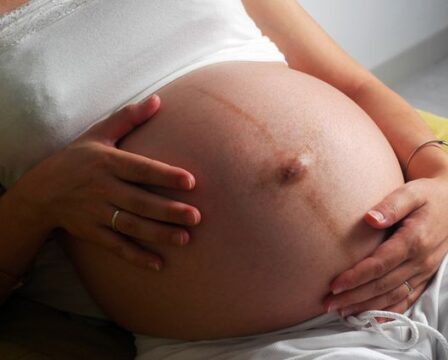 Linea nigra v těhotenství