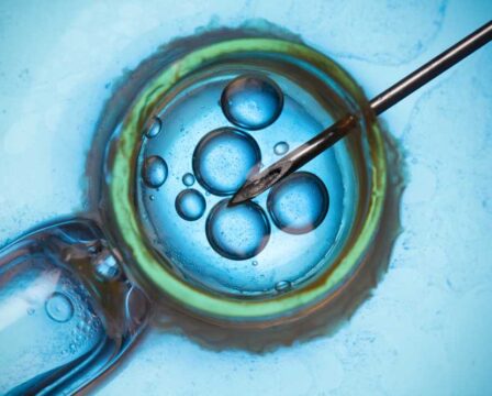 Umělé oplodnění, Genetické testování vajíček pro neplodné páry